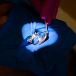 Clinica de medicină dentară DR TEO – Zâmbim oricând împreună! Eroziunea dentară